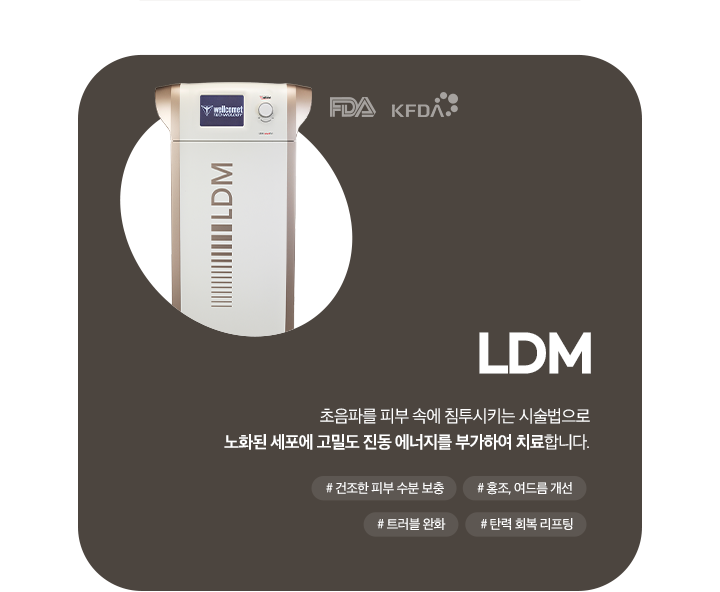LDM