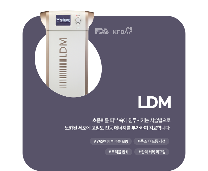 LDM