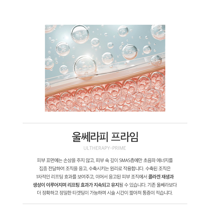 울쎄라
