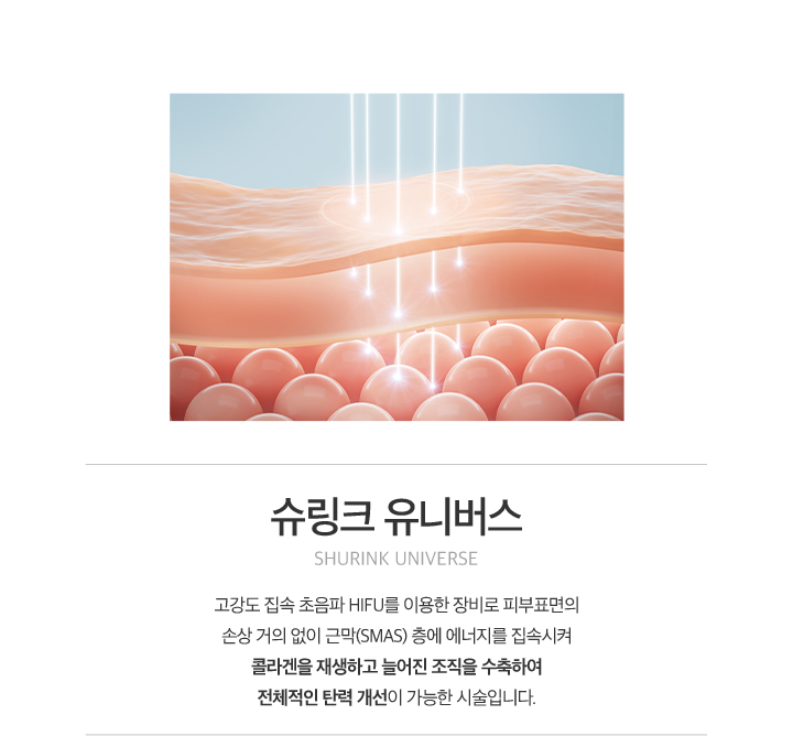 슈링크 유니버스
