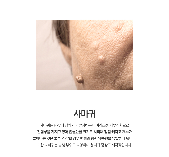 사마귀