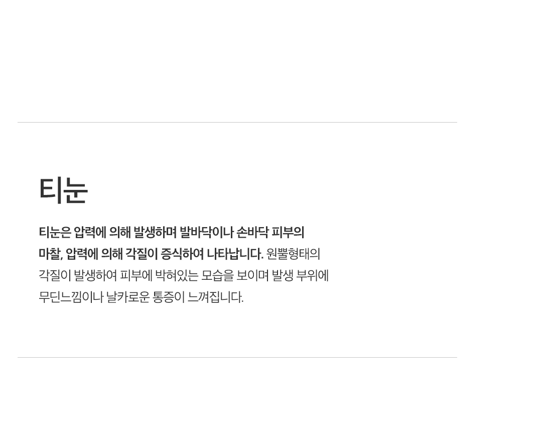 티눈